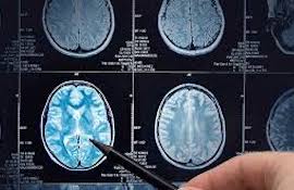 Intraoperable Scanning